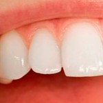el esmalte dental tiene su origen en las escamas de los peces