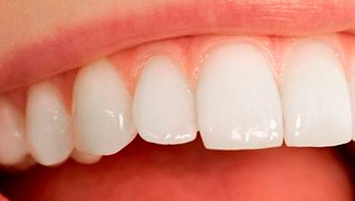 el esmalte dental tiene su origen en las escamas de los peces