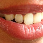 Odontología Bioestética