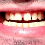 odontología bioestética problemas maticatorios