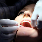 Síntomas que nos indican que tenemos que acudir al dentista