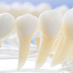 ¿Los implantes dentales duelen?