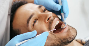 Dudas más frecuentes sobre implantes dentales